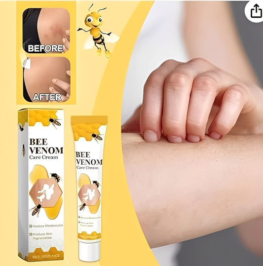 fivfivgo-vitigo-bee-venom-correcting-cream-20g-skin-tone-balancing-and-pigmentation-repair-cream-for-even-healthy-looking-skin