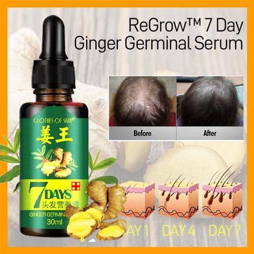 7-day-ginger-germinal-oil-hair-nutrient-solution-hair-growth-essence-liquid-fast-natural-hair-loss-treatment-hair-care-30ml