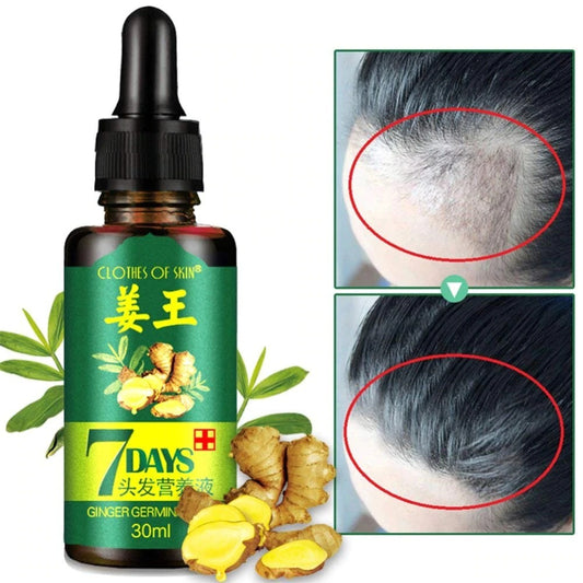 7-day-ginger-germinal-oil-hair-nutrient-solution-hair-growth-essence-liquid-fast-natural-hair-loss-treatment-hair-care-30ml