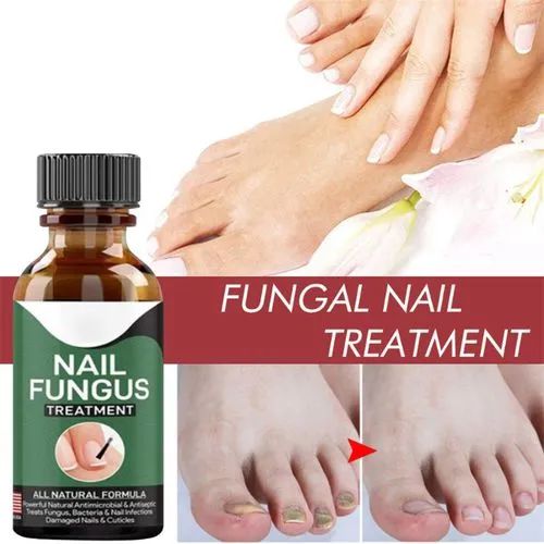 fast-nail-fungus-treatment-gel-nail-repair-essence-serum-for-healthy-smooth-strong-nails