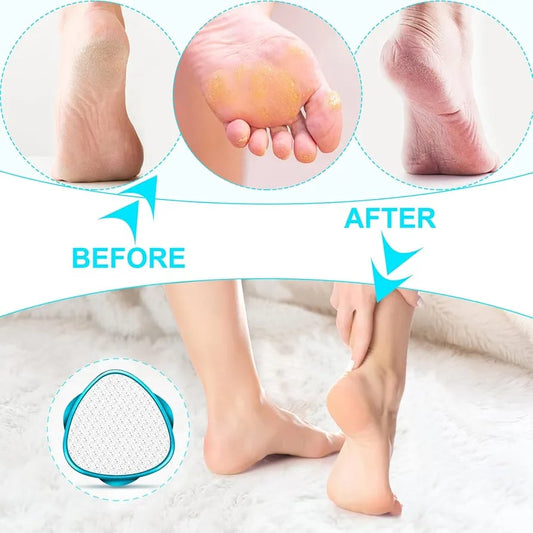 2-in-1-double-sided-nano-glass-callus-remover-crystal-hair-eraser-safe-quick-foot-file-dead-skin-hard-callus-remover-painless-epilator-for-women-portable-pedicure-tool